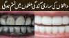 Teeth Whutening In 1 Minute How To Whiten Your Yellow Teeth Naturally Yellow Teeth Cleaning
